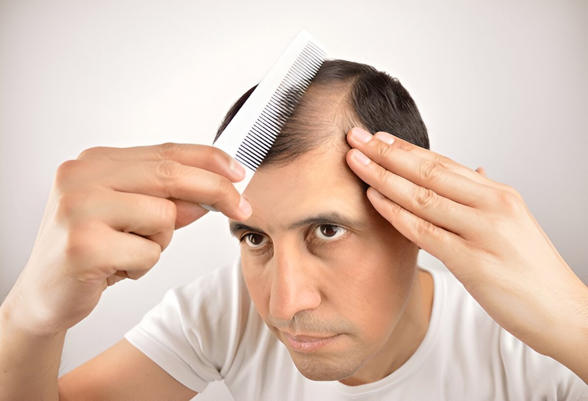 How to Prevent Hair Fall: Science-Backed Strategies for Healthy Hair - Med7 Online