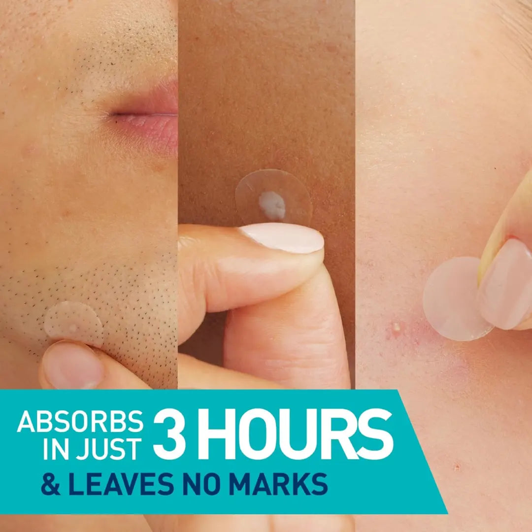 CeraVe Blemish Barrier Patches 22s