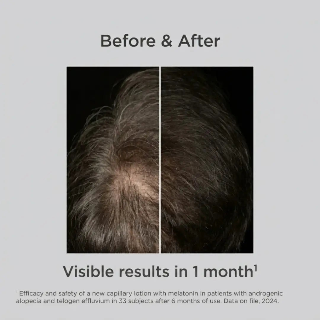 ISDIN Lambdapil Anti-Hair Loss Melatonin Concentrate Lotion Spray 100ml