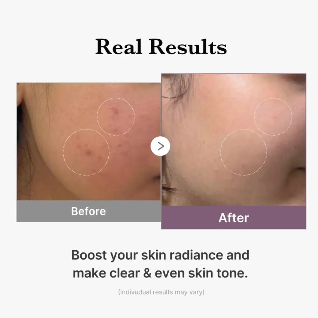 Medicube AGE-R Glutathione Glow Toner 140ml