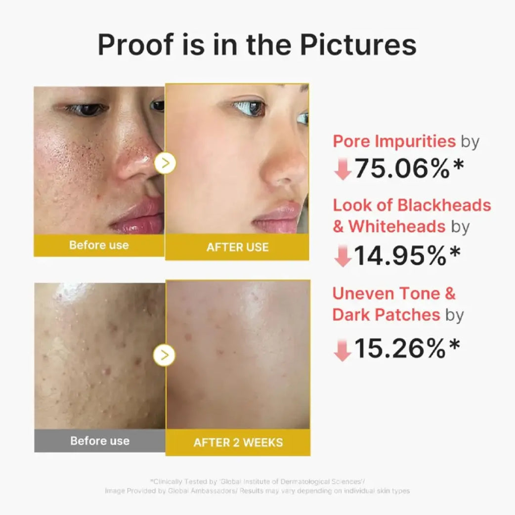 Medicube Kojic Acid Turmeric Peel Shot 80ml
