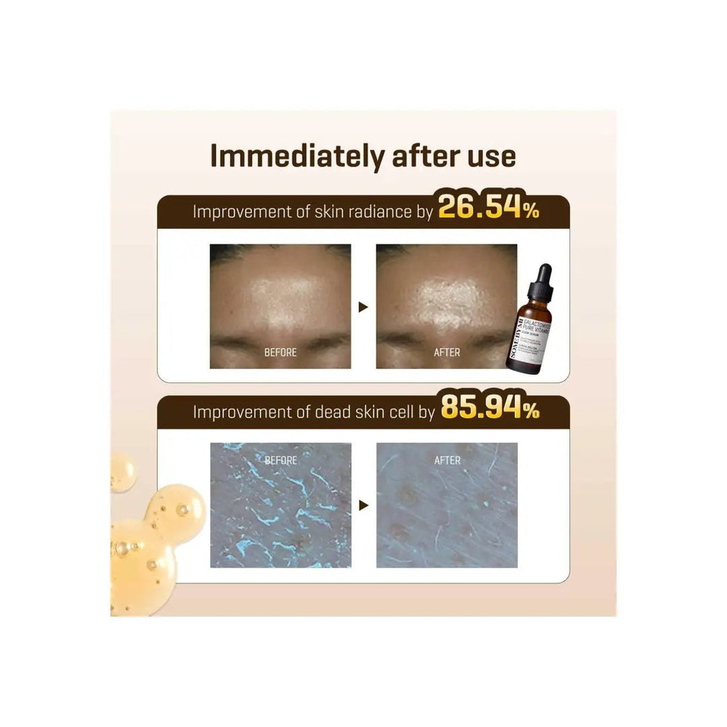 Some By Mi Galactomyces Pure Vitamin C Glow Serum 30ML