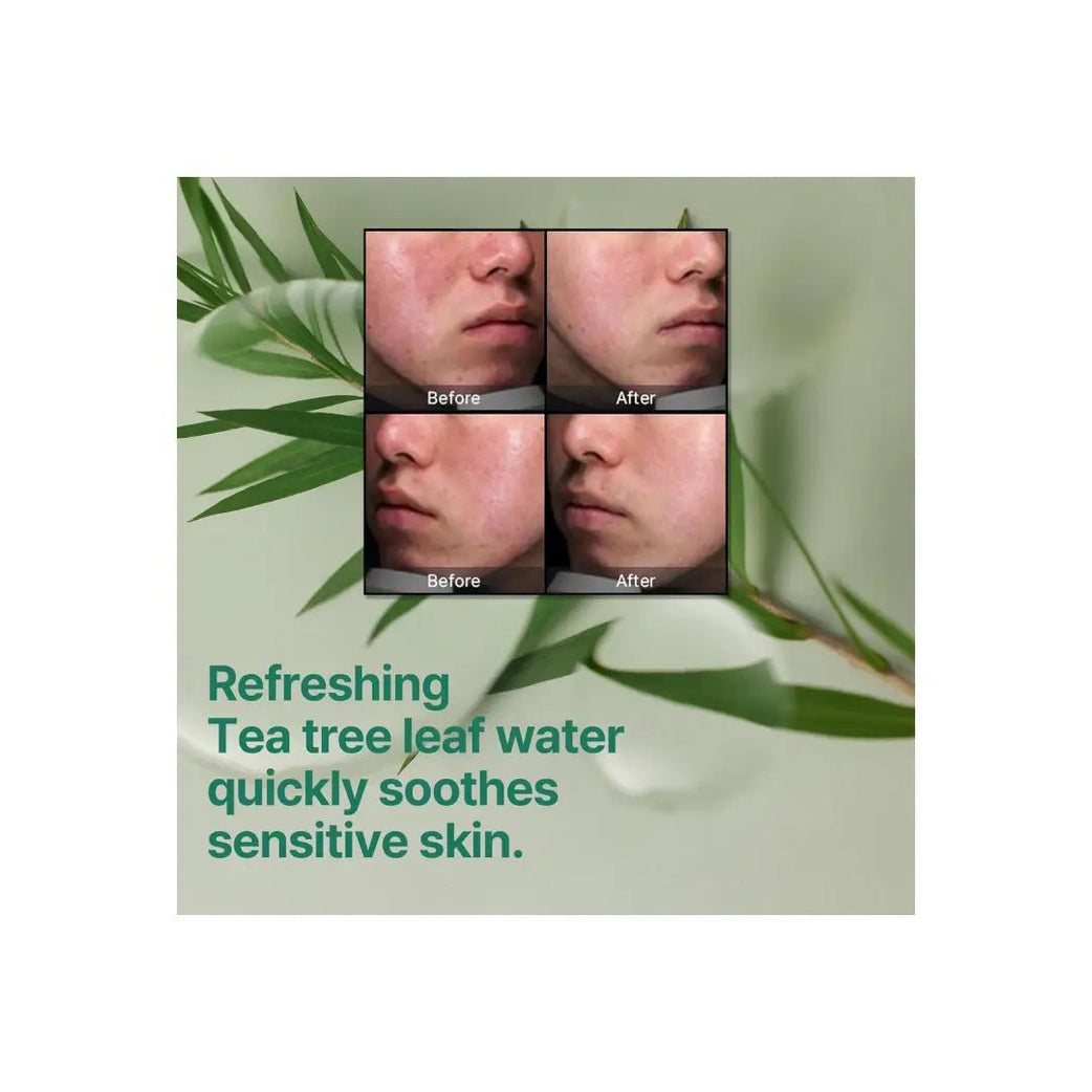 Some By Mi AHA BHA PHA 30 Days Miracle Cream 60G